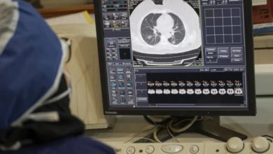 امریکا میں مصنوعی ذہانت کی زبردست پیش رفت: نان اسموکرز میں پھیپھڑوں کے کینسر کی پیش گوئی کرنے والا AI ماڈل تیار