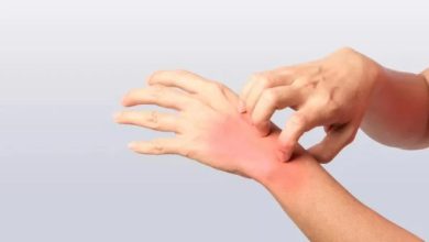 🌡️ کراچی میں گرمی کی شدت اور بجلی کی بندش کے باعث جلدی امراض میں تشویشناک اضافہ