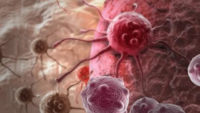 لبلبے کا کینسر: خاموش قاتل، سب سے مہلک کینسر قرار