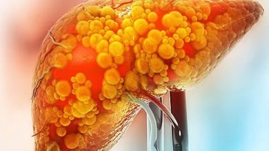 تحقیق: شوگر فری مصنوعات میں سوربیٹل جگر کی مہلک بیماری کا سبب بن سکتی ہے