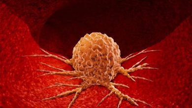 لبلبے کے کینسر سے تعلق رکھنے والی جینیاتی ترتیب دریافت